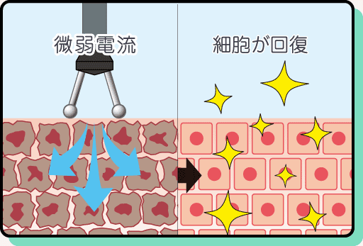 微弱電流が細胞に作用するイメージ図