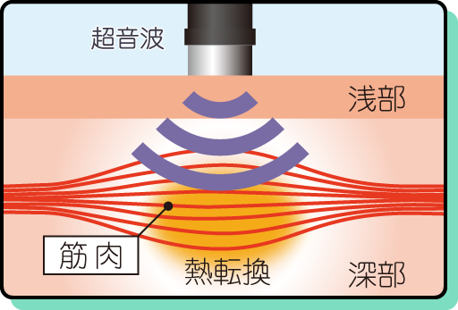 超音波の作用イメージ図